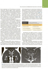 МРТ костно-мышечной системы - Фото 12