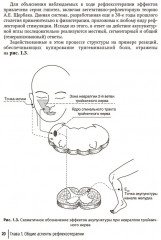 Биопунктурная стимуляция при дорсопатиях - Фото 10