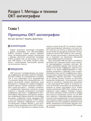 Атлас клинической ОКТ-ангиографии - Фото 7