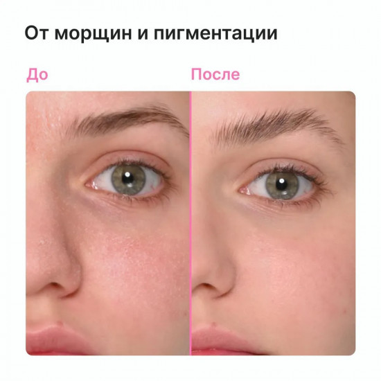 Крем для лица и зоны декольте дневной с мочевиной 10% «Urea 10% + Vitamin E Day Cream»