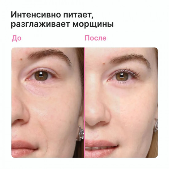 Крем для лица и зоны декольте ночной с мочевиной 15% «Urea 15% + Vitamin E Night Cream»