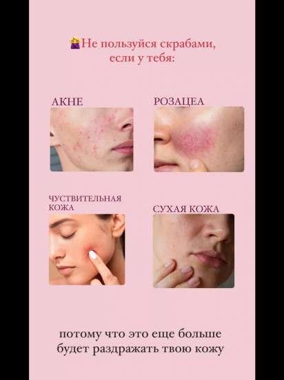 Пилинг-гель для лица «Niacinamide 3% peeling gel»