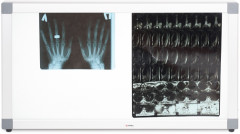 Негатоскоп общего назначения 2-кадровый «Armed» - Фото 5