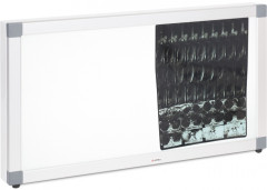 Негатоскоп общего назначения 2-кадровый «Armed» - Фото 8