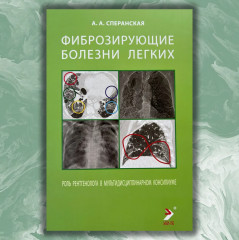 Фиброзирующие болезни легких. Роль рентгенолога в мультидисциплинарном консилиуме - Фото 1
