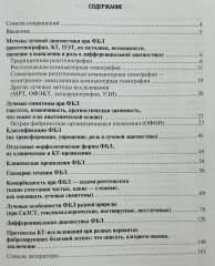 Фиброзирующие болезни легких. Роль рентгенолога в мультидисциплинарном консилиуме - Фото 2