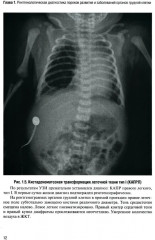 Неотложная рентгенодиагностика в неонатологии и педиатрии - Фото 7