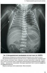 Неотложная рентгенодиагностика в неонатологии и педиатрии - Фото 8