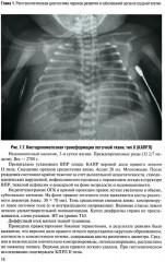 Неотложная рентгенодиагностика в неонатологии и педиатрии - Фото 9