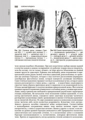 Терапевтическая стоматология - Фото 6