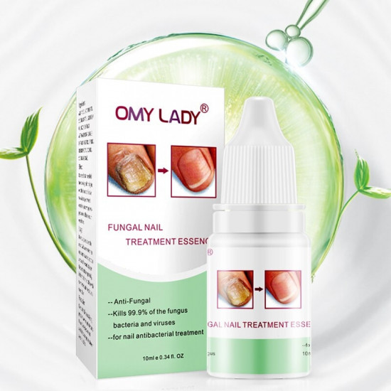 Восстанавливающий крем для ногтей «Fungal Nails Treatment»