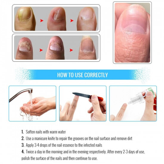 Восстанавливающий крем для ногтей «Fungal Nails Treatment»
