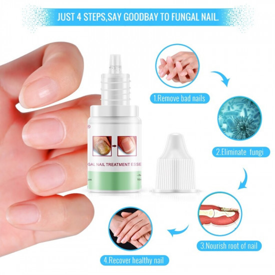 Восстанавливающий крем для ногтей «Fungal Nails Treatment»