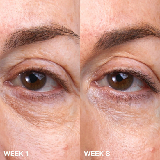Крем для кожи вокруг глаз «Super Boost Eye Cream»