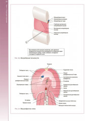 Наглядная пульмонология - Фото 9