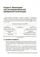 Экстракорпоральная мембранная оксигенация при лечении критической сердечной и дыхательной недостаточности - Фото 6