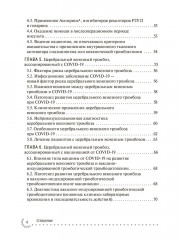 Нарушения кровообращения, ассоциированные с COVID-19. Руководство для врачей - Фото 1