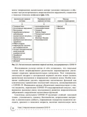 Нарушения кровообращения, ассоциированные с COVID-19. Руководство для врачей - Фото 4