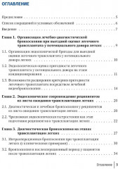 Эндоскопические внутрипросветные технологии в трансплантации легких - Фото 1