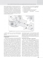 Болезнь Паркинсона и двигательные нарушения - Фото 8