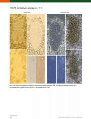 Анализ осадка мочи - Фото 8