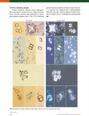 Анализ осадка мочи - Фото 9