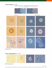 Анализ осадка мочи - Фото 10