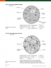 Анализ осадка мочи - Фото 11