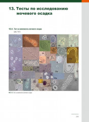 Анализ осадка мочи - Фото 13