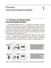 Интерпретация ЭКГ в клинической практике - Фото 6