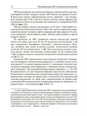 Интерпретация ЭКГ в клинической практике - Фото 7