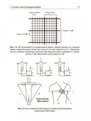 Интерпретация ЭКГ в клинической практике - Фото 8