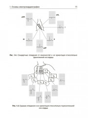 Интерпретация ЭКГ в клинической практике - Фото 10