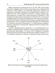 Интерпретация ЭКГ в клинической практике - Фото 11
