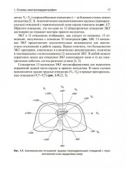 Интерпретация ЭКГ в клинической практике - Фото 12