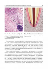 Одонтогенные кисты челюстей - Фото 5