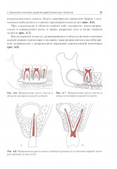 Одонтогенные кисты челюстей - Фото 7