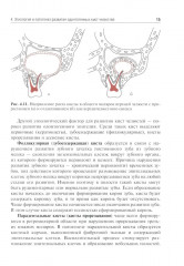Одонтогенные кисты челюстей - Фото 9