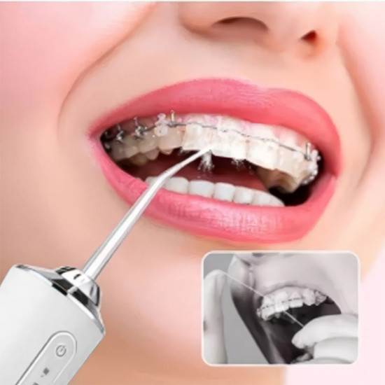 Ирригатор для полости рта портативный «Oral Irrigator»