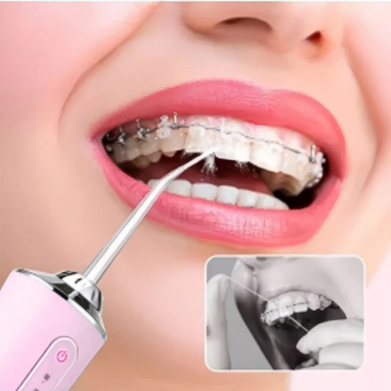 Ирригатор для полости рта портативный «Oral Irrigator»