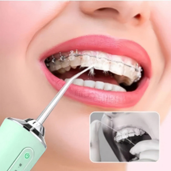 Ирригатор для полости рта портативный «Oral Irrigator»