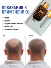 Активатор роста волос «101» - Фото 1