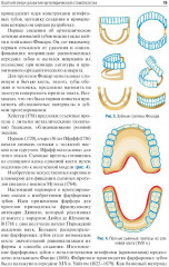 Ортопедическая стоматология. Факультетский курс - Фото 11