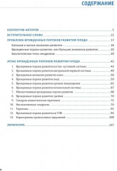 Врожденные пороки развития плода. Атлас - Фото 1