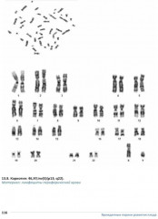 Врожденные пороки развития плода. Атлас - Фото 6