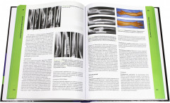 Ортопедия и травматология по Эпли. В 3 частях. Часть 3 - Фото 1