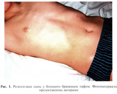 Инфекционные болезни - Фото 11