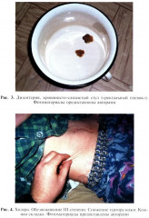 Инфекционные болезни - Фото 12