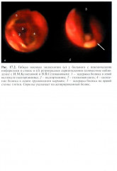 Реабилитация неврологических больных - Фото 10