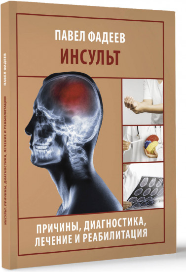 Инсульт. Причины, диагностика, лечение и реабилитация